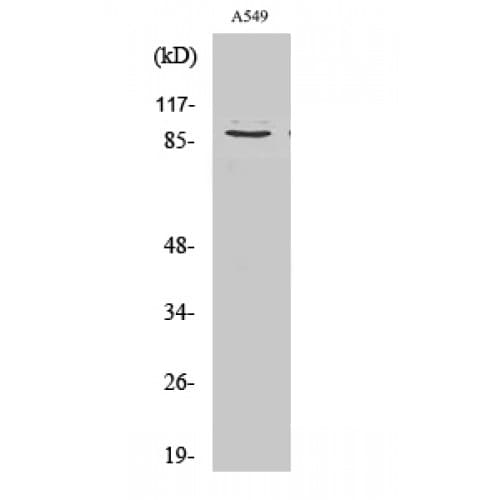 COL3A1 / Collagen III Antibody (1140-1220 aa, C-terminal)