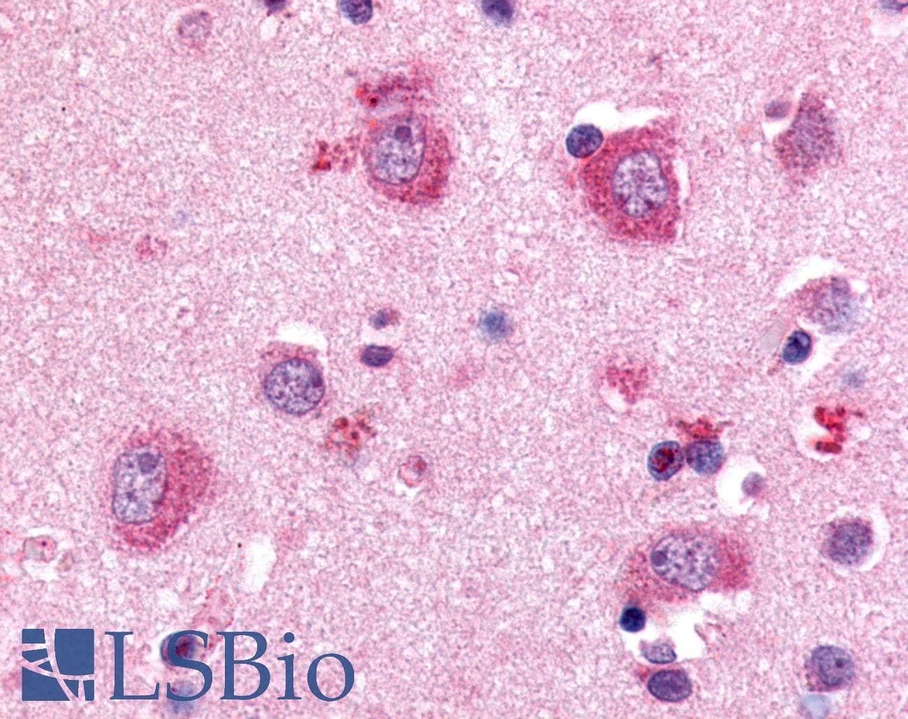 PathPlus™ P2RY8 / P2Y8 Antibody (Cytoplasmic Domain)