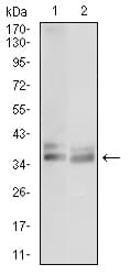 PathPlus™ ACP5 / TRAP Antibody (aa221-325, clone 5C5E7)