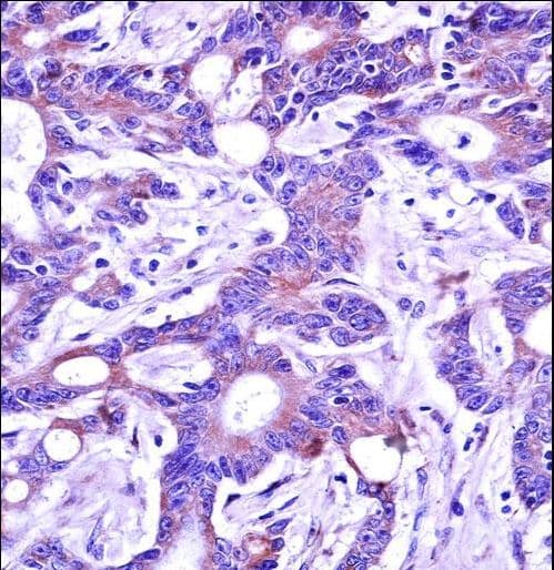 USP4 Antibody (aa1-30)