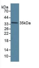 Polyclonal Rabbit anti-Human ANXA5 / Annexin V Antibody (PE, aa1-320, WB)