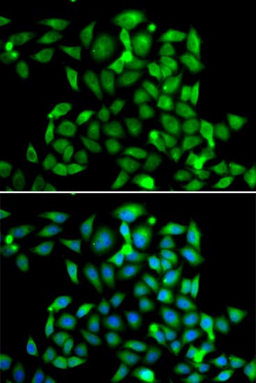 CLASP1 Antibody