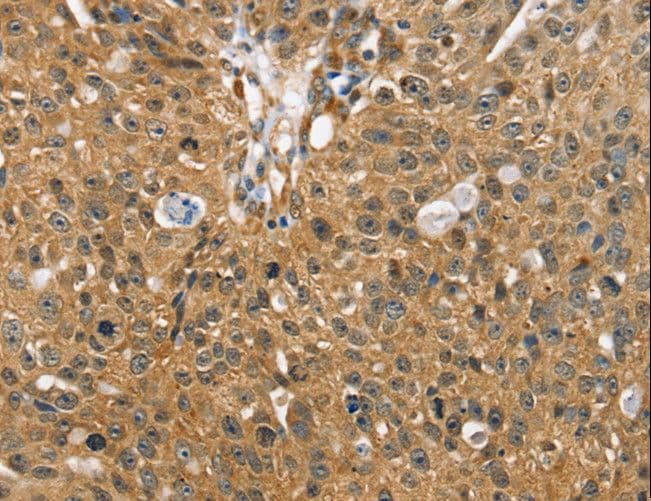 SORT1 / Sortilin Antibody