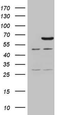 Monoclonal Mouse anti-Human CCDC36 Antibody (clone OTI1H3, Carrier-free, WB)