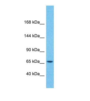 Polyclonal Rabbit anti-Human ZNF681 Antibody (aa81-130, WB)