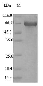 Human ACS5 / ACSL5 Protein (Recombinant 6His, N-terminus)