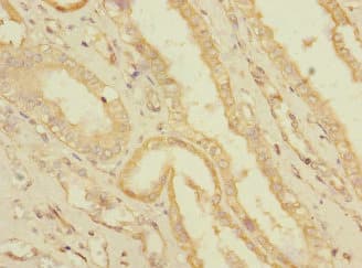 Polyclonal Rabbit anti-Human SLC36A3 Antibody