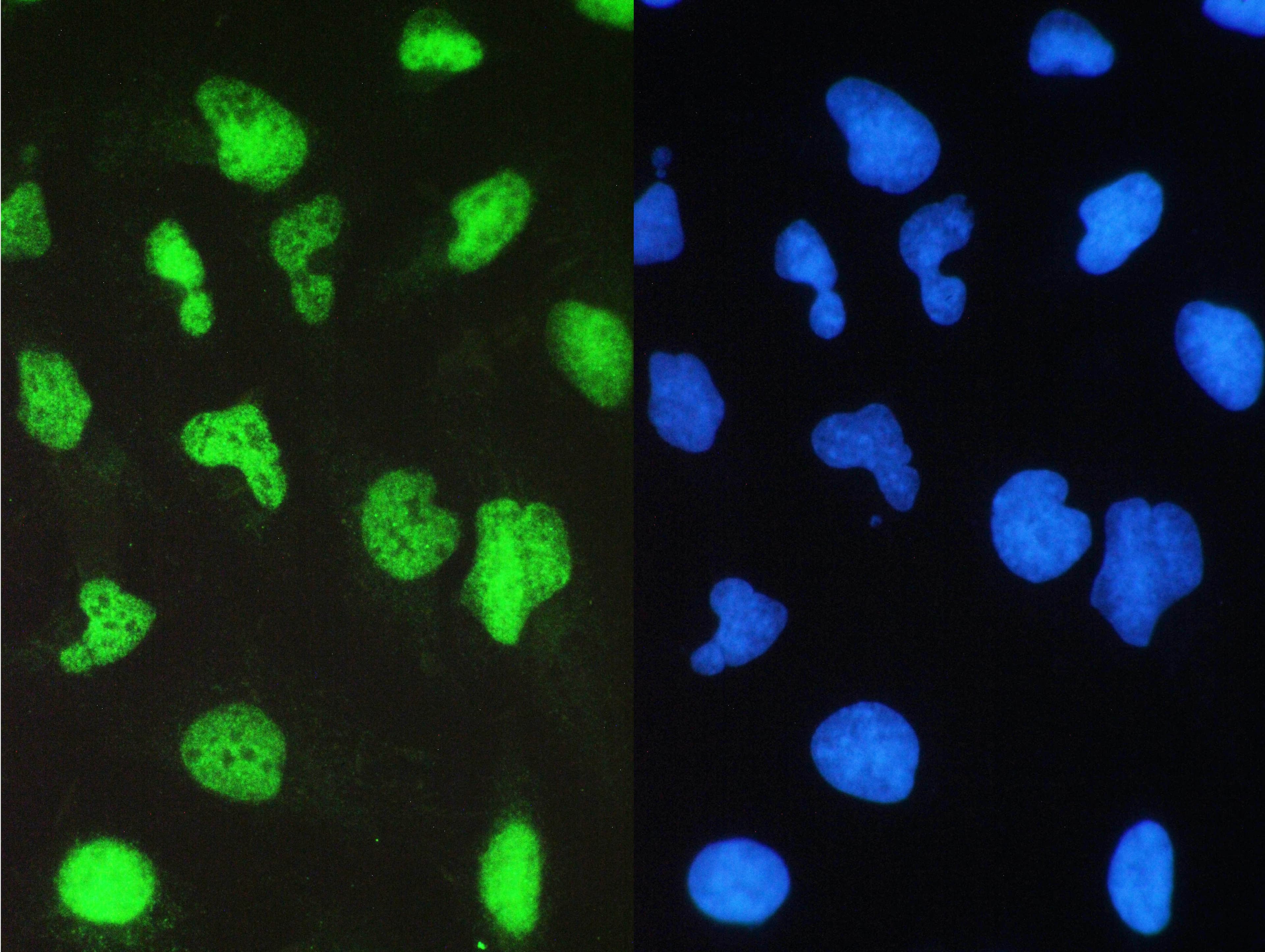 Polyclonal Rabbit anti-Human SMARCA4 / BRG1 Antibody (IHC, WB)