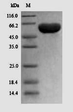 Human PPARG / PPAR Gamma Protein (Recombinant 6His, N-terminus)