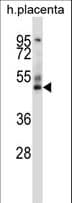 Polyclonal Rabbit anti-Human GRAMD3 Antibody (aa15-43, WB)