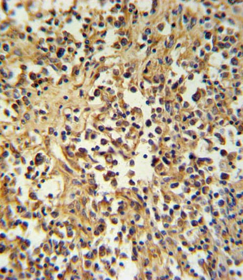 Polyclonal Rabbit anti-Human GZMM / Granzyme M Antibody (aa84-113, IHC, WB)
