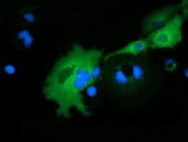 ARHGAP25 Antibody (clone OTI11D3)