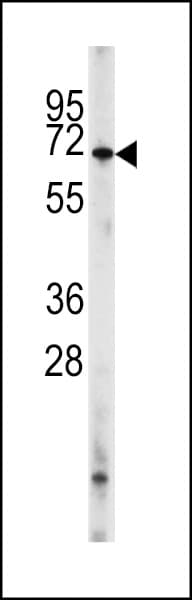 Polyclonal Rabbit anti-Human PDE8A Antibody (aa557-587, IHC, WB)