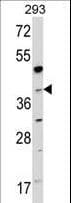 Polyclonal Rabbit anti-Human NAGK Antibody (aa300-330, WB)