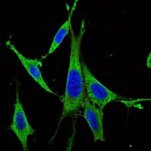 Monoclonal Mouse anti-Human MAPK3 / ERK1 Antibody (clone 100000, IHC, IF, WB)