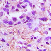 PDGF-AA Antibody (Internal)