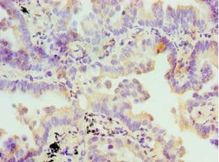 IHC-plus™ FDFT1 / Squalene Synthase Antibody (aa1-260)