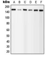 Polyclonal Rabbit anti-Human PLCG1 Antibody (phospho-Tyr1253, IF, WB)
