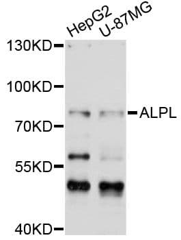 ALPL / Alkaline Phosphatase Antibody