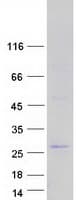 Human FBXO36 / F-Box Protein 36 (Recombinant Myc-DDK (Flag))