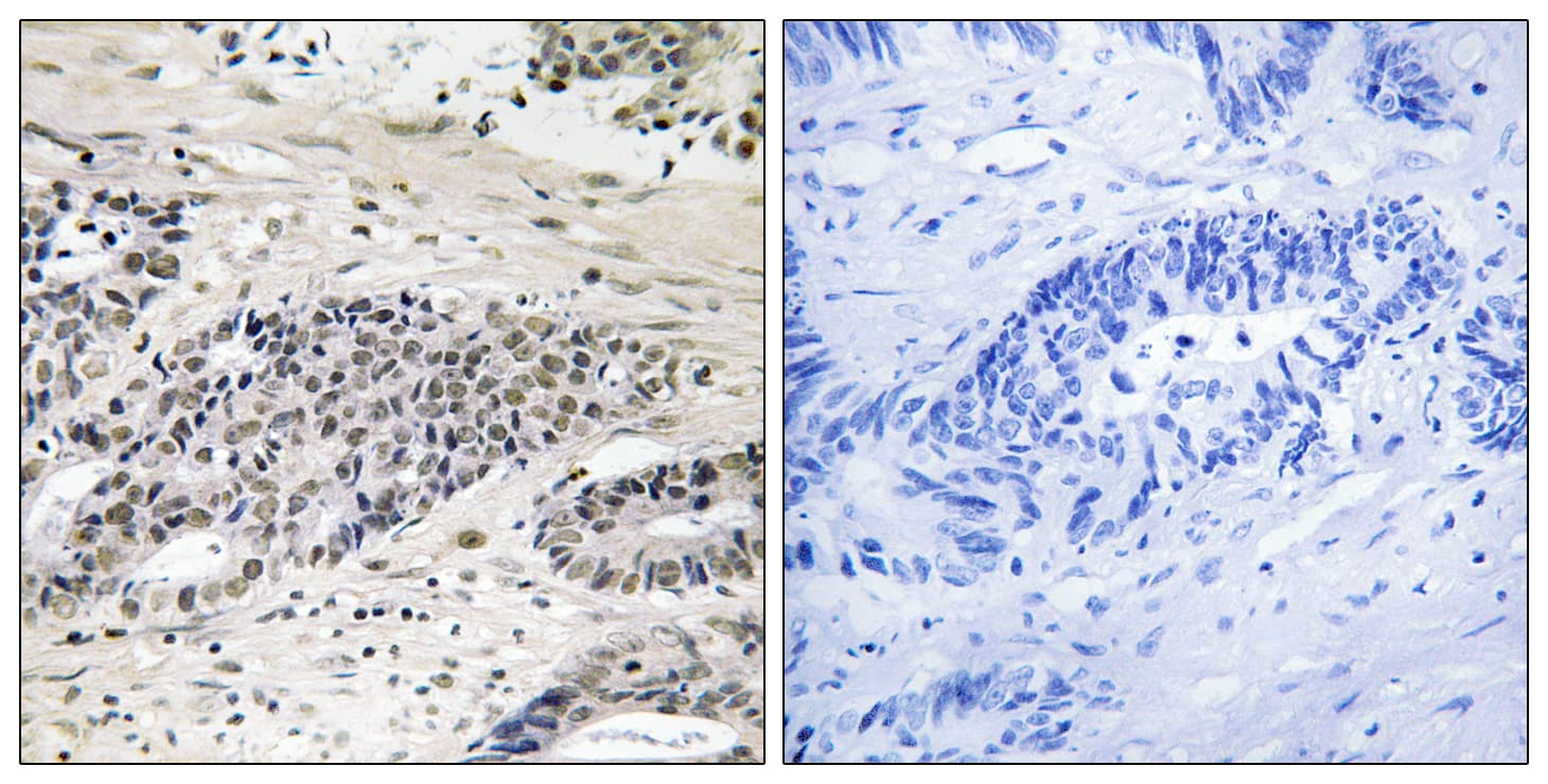 Polyclonal Rabbit anti-Human AURKA / Aurora-A Antibody (phospho-Ser342, IHC)