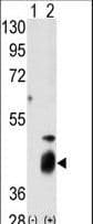 DUSP7 Antibody (aa96-127)