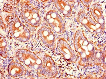 IHC-plus™ PRSS2 / Trypsin 2 Antibody