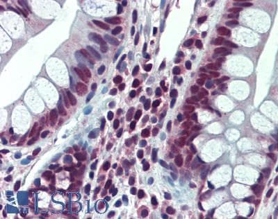 IHC-plus™ TOP1 / Topoisomerase I Antibody (aa100-150)