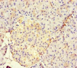 Polyclonal Rabbit anti-Human RUNX1T1 / ETO Antibody (IHC, WB)