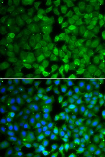 IHC-plus™ Polyclonal Rabbit anti-Human RUNX3 Antibody (IHC, IF, WB)
