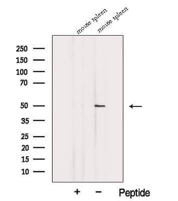Polyclonal Rabbit anti-Human TDP2 / TTRAP Antibody (WB)