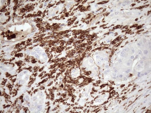 URP2 / FERMT3 Antibody (aa259-528, clone OTI3C7)