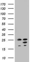 ARFL3 / ARL3 Antibody (aa2-182, clone OTI2G7)