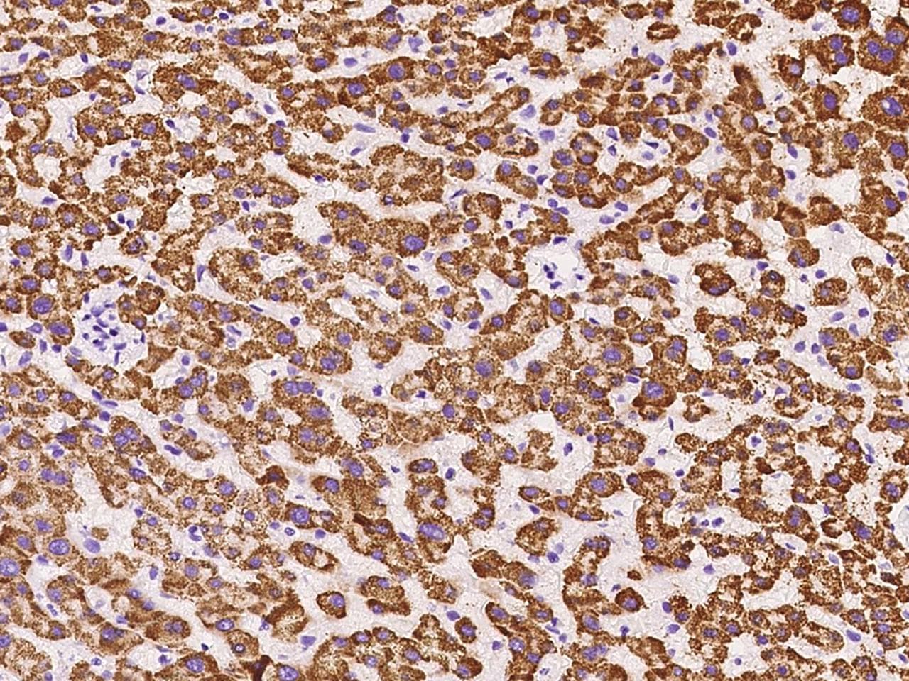 Polyclonal Rabbit anti-Human GLYAT Antibody (IHC)
