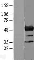 NLE1 Protein (Over-Expression Lysate Myc-DDK (Flag))