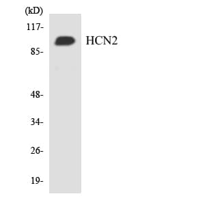 HCN2 Antibody (aa472-521)
