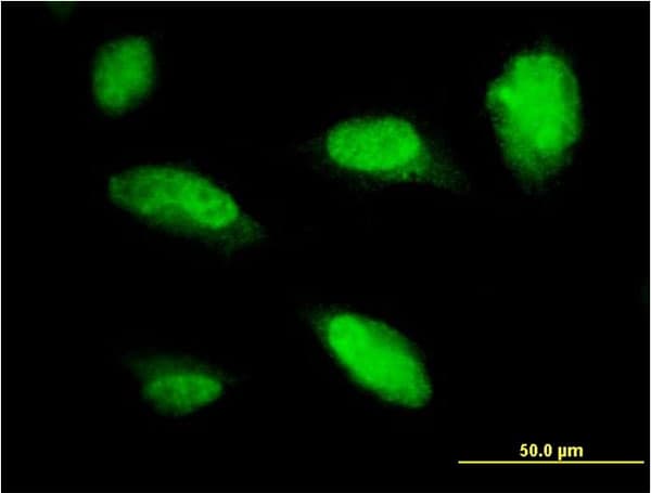PHOX2A Antibody (clone 4F6)
