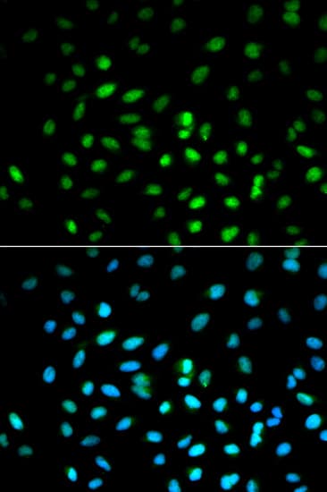 PathPlus™ STK11 / LKB1 Antibody