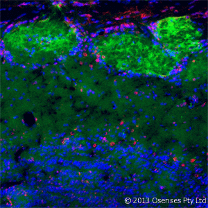 NGFR / CD271 / TNR16 Antibody (clone MC192)