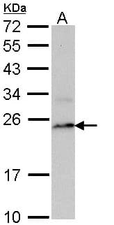 PSMB8 / LMP7 Antibody (aa52-276)