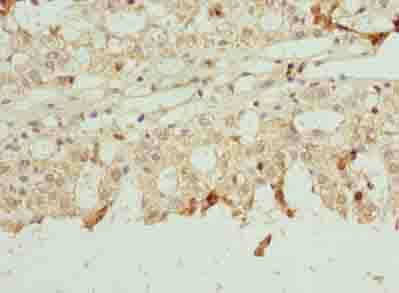 NETO2 Antibody