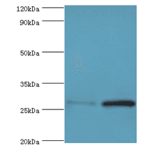 ACRV1/Intra-Acrosomal Protein Antibody (aa22-265)