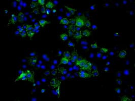 ATP5B / ATP Synthase Beta Antibody (clone OTI9E3, Carrier-free)