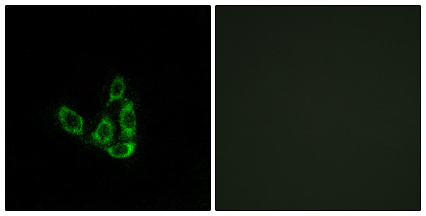 IHC-plus™ GCNT3 Antibody (aa226-275)