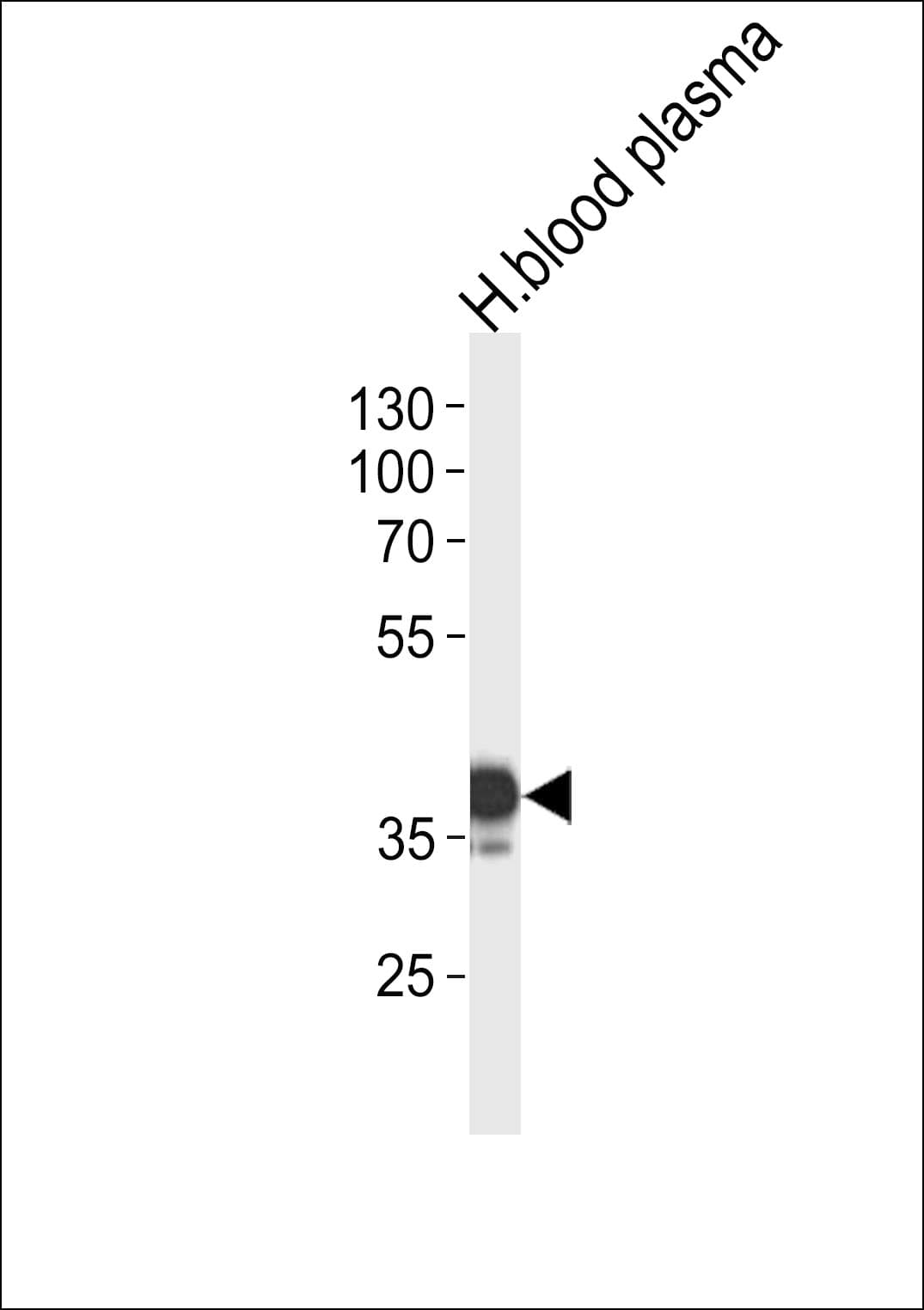 SERPINA7 / TBG Antibody (aa37-65)