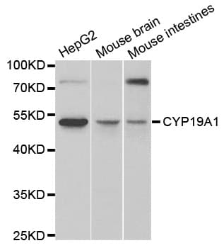 Polyclonal Rabbit anti-Human CYP19 / Aromatase Antibody (IHC, WB)