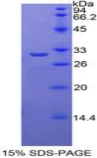 Mouse TRADD Protein (Recombinant His-T7)