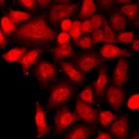 TLK2 Antibody