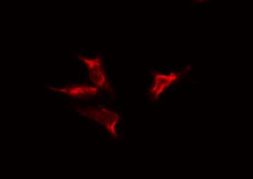 NUTF2 / PP15 Antibody