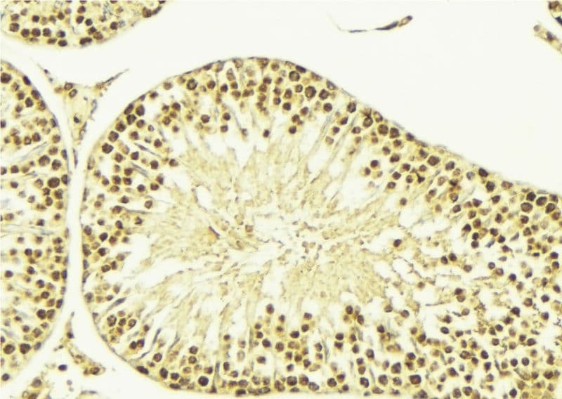 CAMK4 / CaMK IV Antibody